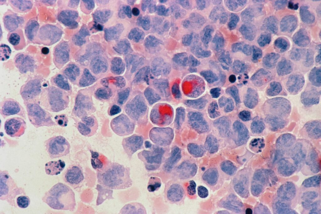blood smear microscope — Vitalheros