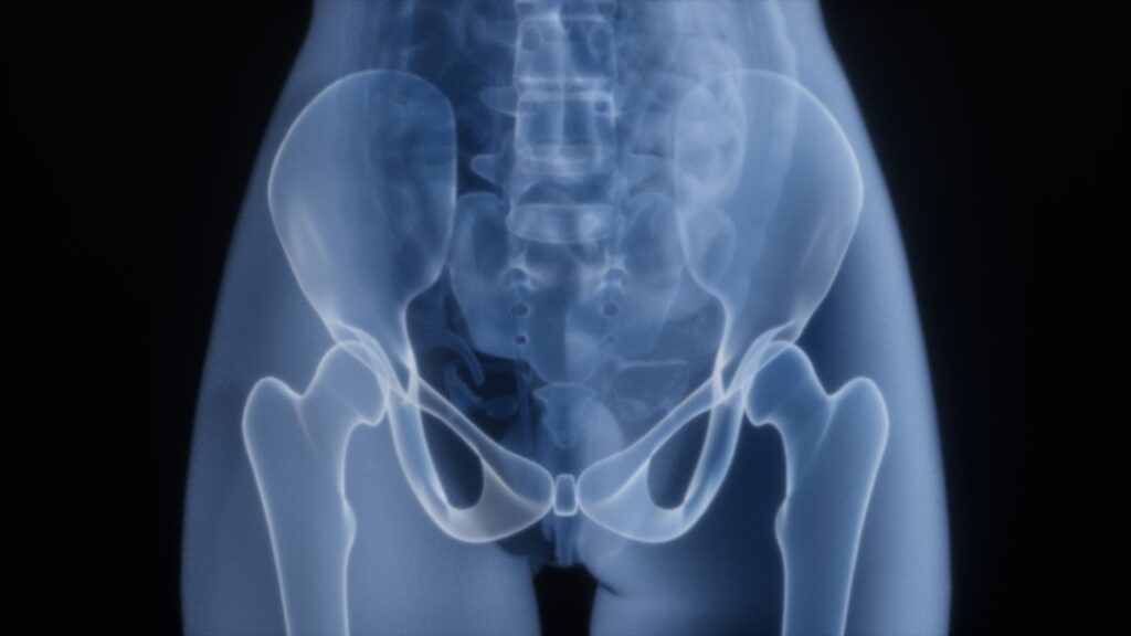 bone health research — Vitalheros
