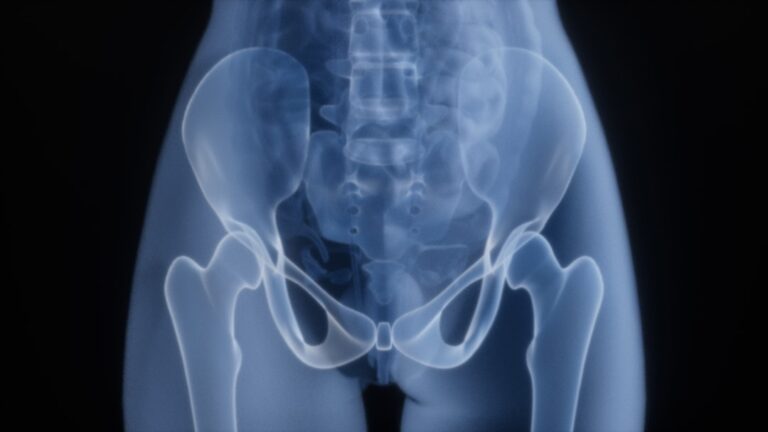 Targeting a Key Culprit in Bone Aging: A Novel Macrophage Therapy Shows Promise