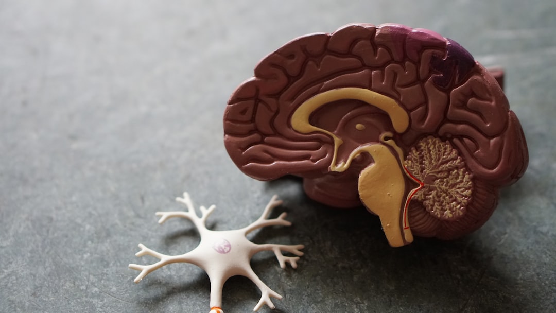 brain connections strength — Vitalheros