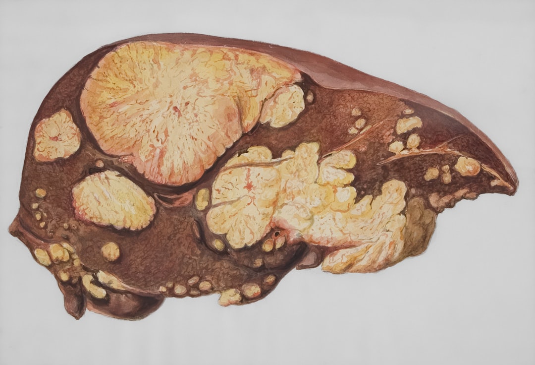 Liver health scan — Vitalheros
