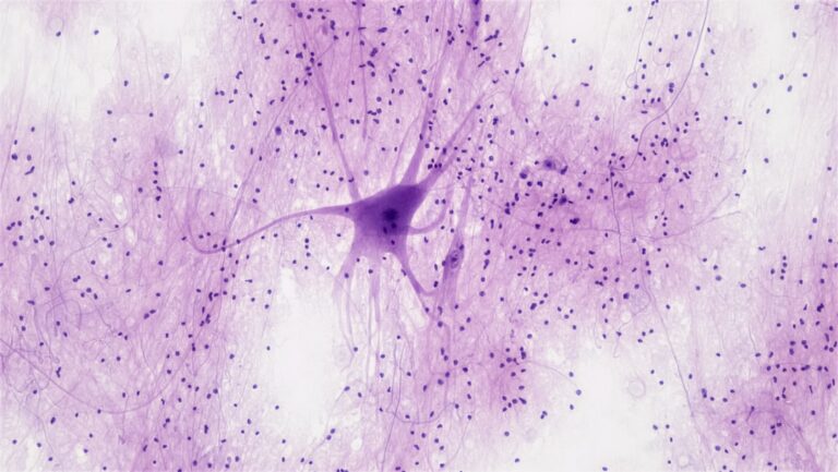 Unraveling Alzheimer’s: How Neurons’ Unique Clean-Up Crew Fails