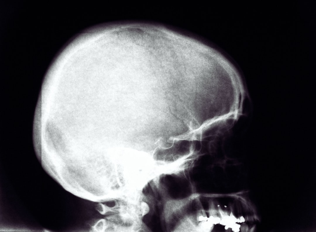 pediatric skull development — Vitalheros